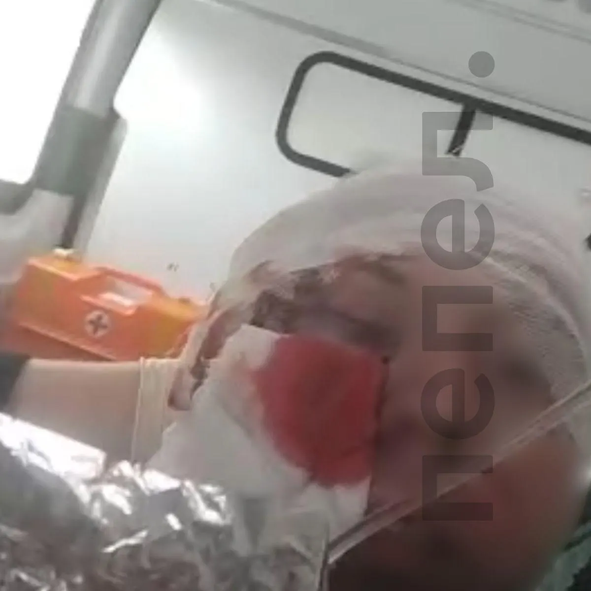 Пострадавший при обстреле пожарной части утверждает, что бывшее руководство получило статус ветеранов боевых действий, тогда как простые пожарные не получили приграничных надбавок, компенсаций и поддержки после травм.