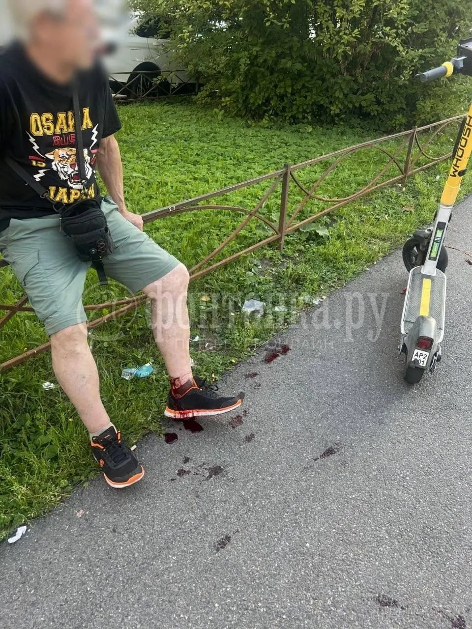Пенсионер получил глубокую рану на ноге и значительную кровопотерю; его госпитализировали, позже выписали в удовлетворительном состоянии.